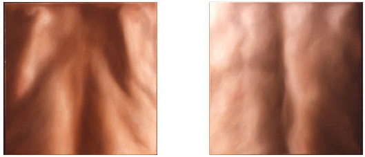 Skin Diptych (Tim and Mark)